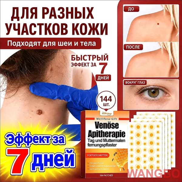 Пластырь от папиллом, бородавок, родинок,угревой сыпи 144шт(10)