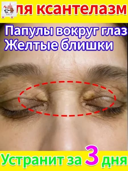 Мазь для век Янкан Гаой против ксантелазмы и атеромы традиционный китайский рецепт