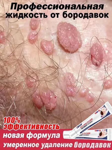 колломак от бородавок и папиллом,эффективного удаления бородавок и папиллом на лице, теле, руках и ногах. Без боли, без следов, без побочных эффектов.