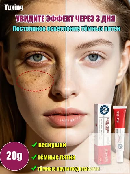 YUXING Крем для осветления веснушек, пигмента и темных кругов под глазами 20г 1 шт