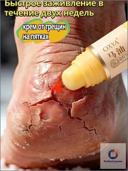 Крем воск для ног с мочевиной 5 , от трещин на пятках, увлажняющий-52