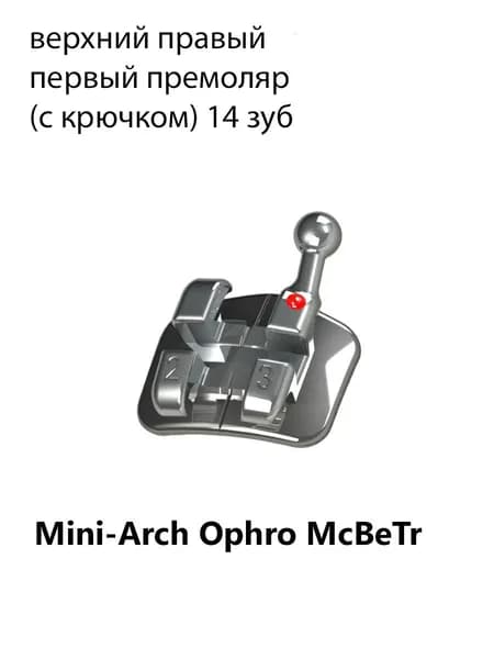 Брекет Mini-Arch Ophro McBeTr, металлический, верхний правый первый премоляр с крючком, 0,56 мм IMD