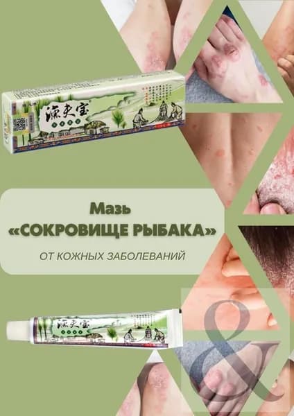Крем Сокровище рыбака 15 гр от псориаза, экземы и дерматита