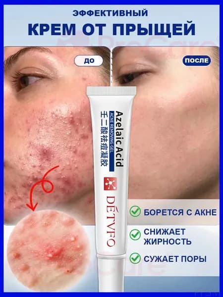 Качественный крем DETVFO от высыпаний, 20 мл, для проблемной дермы pengfeishangmao