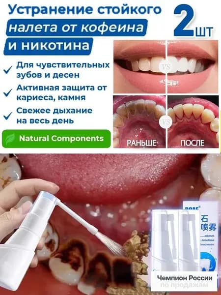 Зубной спрей для растворения зубного камня,2 шт.
