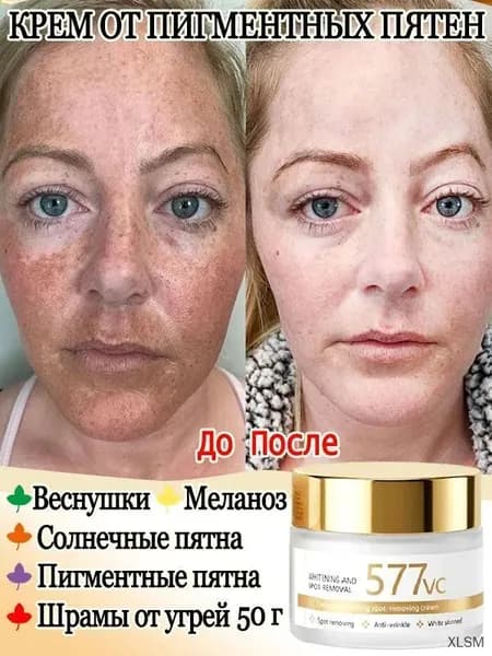 Крем для лица от пигментации с витамином C, эффективно удаляет меланин, смягчает хлоазмы и различные пигментн