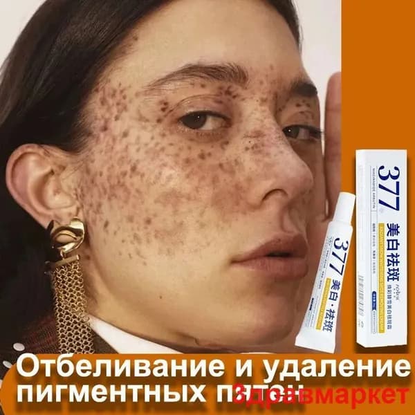 Крем для отбеливания и удаления веснушеk,50g, для удаления веснушек, пигментных пятен, мелазмы,для комплексного ухода кожи, осветляющий скрывает