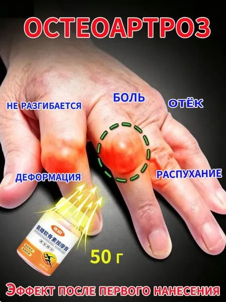 Мазь от артрита, Устранение боли при воспалении суставов, коленях, пальцах рук и т. д, на конечностях и для спины и артроза 50 г