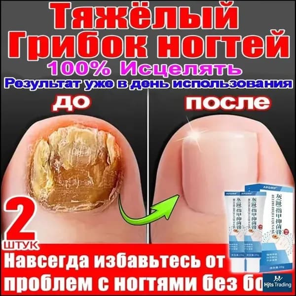 2 штуки,крем ноготок от грибка ногтей на ногах,ноготок мазь от грибка на ногах,гиперкератоз