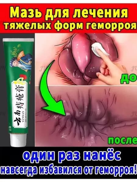 Китайская ЧУДО МАЗЬ от геморроя, 100% натуральная, не гормональная, крем от геморроя Чжи Чуан Гао 15 г