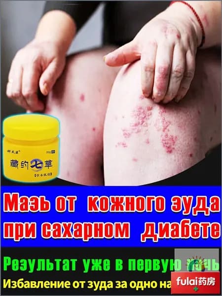 Мазь от кожного зуда при диабете быстрое облегчение
