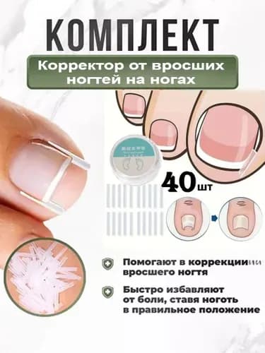 Корректор От Вросших Ногтей На Ногах