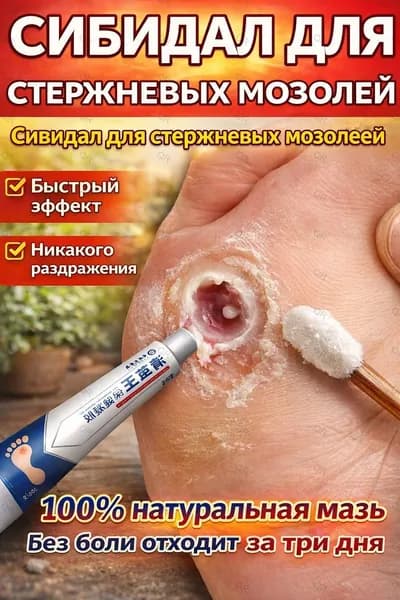Средство от шипиц, натоптышей и сухих стержневых мозолей на ногах мазь и гель Корнекс,эффективное китайское средство