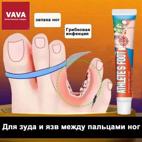 Средство от запаха ног для зуда и язв между пальцами, против грибка, дезодорант эффективное 20г