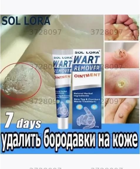 Крем против бородавок SOL LORA anti-wart flat для удаления бородавок
