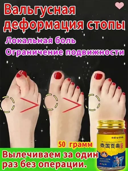Легендарный тайский крем от косточки на ноге