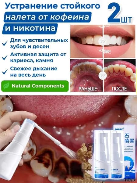 Зубной спрей для растворения зубного камня,2 шт.