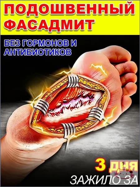 мазь от боли в пятках,пластырь обезболивающий для суставов и мышц,мазь ям,аппарат витафон для лечения пяточной шпоры, 20g