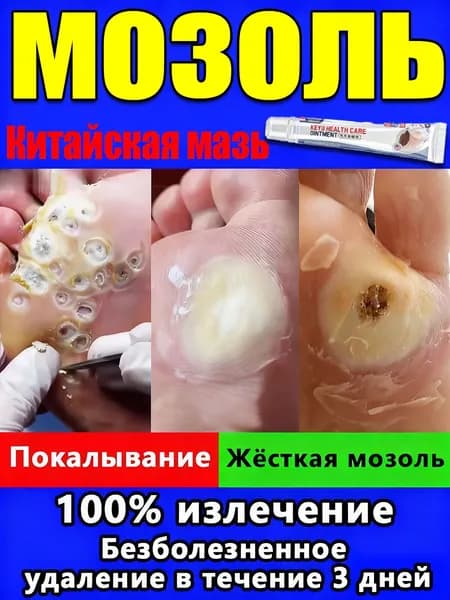 китайский Мазь от мозолей стержневых, колломак от бородавок, салипод от стержневых мозолей, Быстродействующий, Не содержит гормонов, Подходит для лица, шеи, рук, ног, ступней и всего тела.