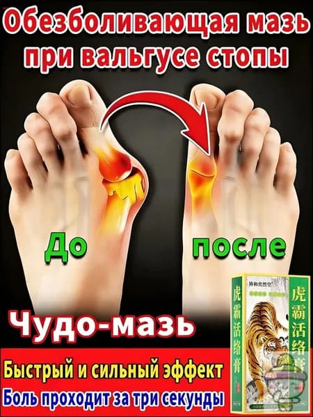 мазь от косточки на большом пальце, от шишек на больших пальцах ног