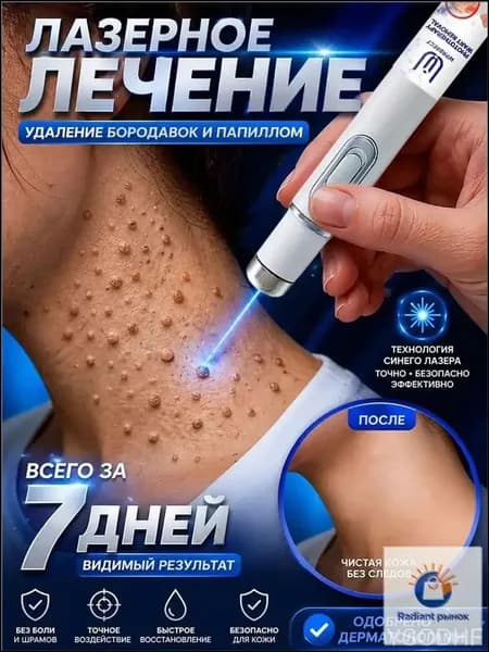 Используется для безболезненного удаления бородавок, папиллом и родинок, не оставляя шрамов.