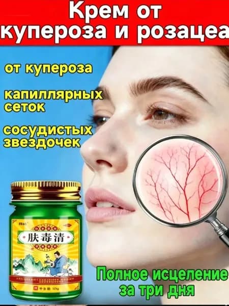 Эксклюзивная мазь от купероза, покраснений и розацеа наносится.