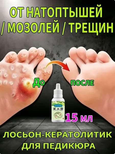 Кератолик от мозолей на ногах, средство от натоптышей и стержневых мозолей, средства для маникюра или педикюра