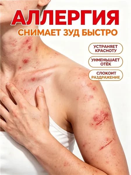 Крем от аллергии быстро снимает зуд, устраняет покраснение, уменьшает отек и снимает раздражение. Эффективные средства для облегчения симптомов кожной аллергии