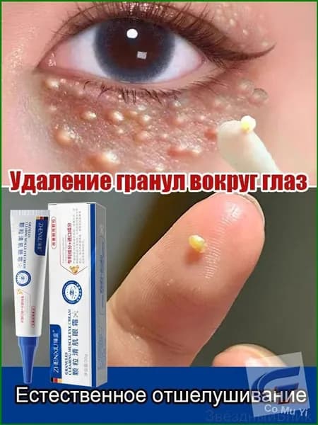 Анти-жировиковый крем для век, устраняет жировики, разглаживает кожу, 30 г