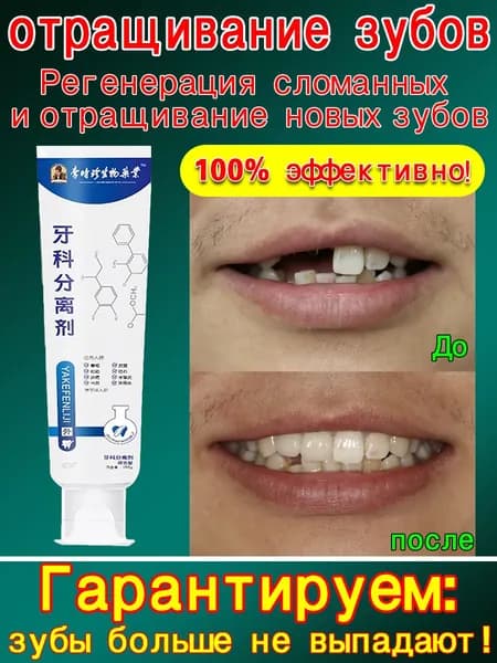 Лечебная зубная паста: регенерация и отращивание зубов, восстановление сломанных, ремонт эмали, укрепление десен, защита от выпадения