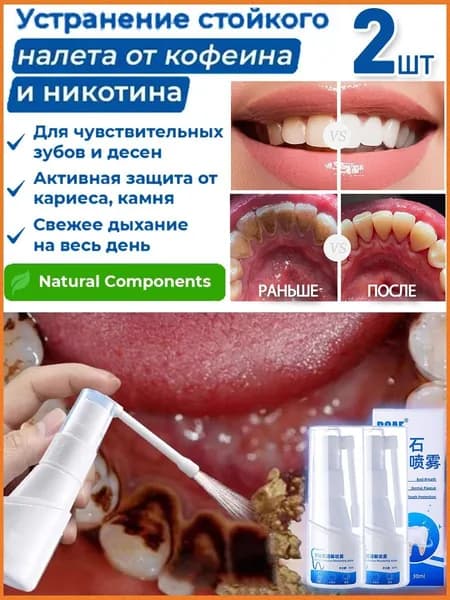 Эксклюзивный спрей против зубного камня, 2 шт