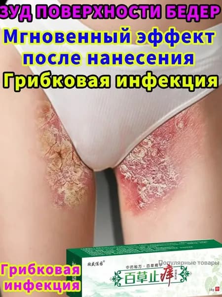 Мазь от Экзема псориаза на внутренней поверхности бедра, быстрое снятие воспаления и успокоение кожи для про