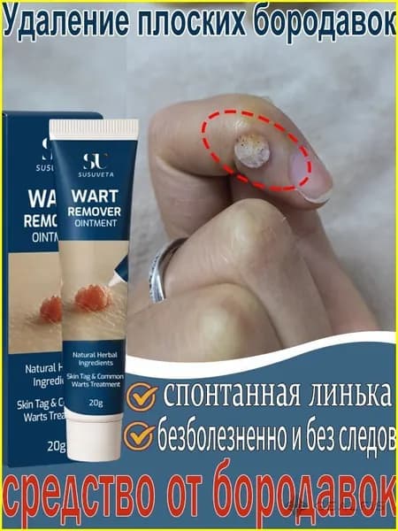 7 дней без следов удаление Мазь от бородавок, для рук, для шеи, чистотел от бородавки, от сухих мозолей 20 мл