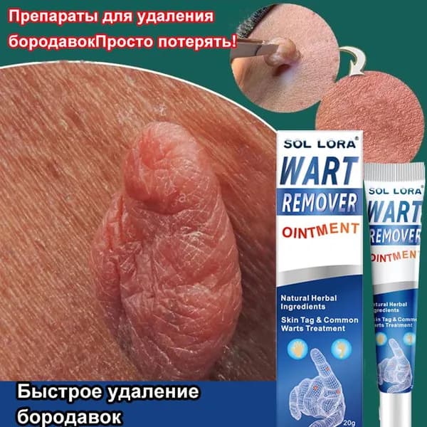 Мазь от бородавок, Крем средство для удаления бородавок, папиллом и родинок, безболезненно, не оставляет следов без побочных эффектов / 20г