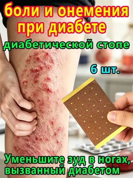 Пластырь от онемения рук и ног при диабетической нейропатии