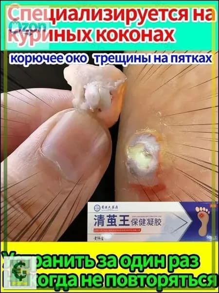 средство для удаления натоптышей на ногах.Быстрый эффект/20 г