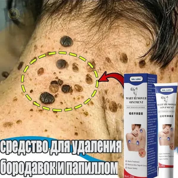 Крем гель от папиллом, чистотел, средство от бородавок.Натуральные растительные ингредиенты,20 гм