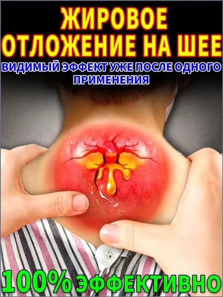 мазь от горба на шее,от для шейного остеохондроза, Помогает при шишке на шее, сдавлении нерва, боли и припухлости