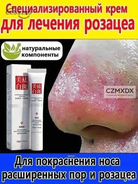 Мазь от розацеа на лице купероза и покраснений 30 г