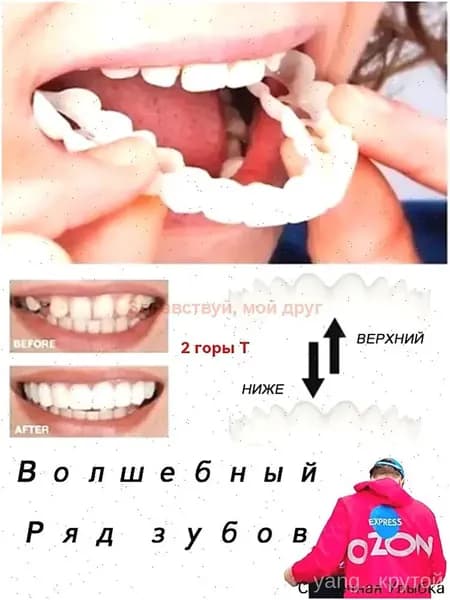 многоразовый защелкивающийся протез для взрослых perfect smile