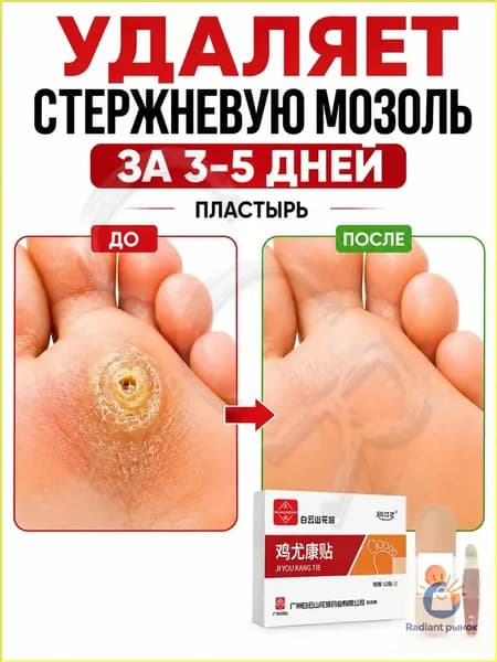 Эксклюзивный набор из 12 пластырей применяется для устранения натоптышей, стержневых мозолей и бородавок