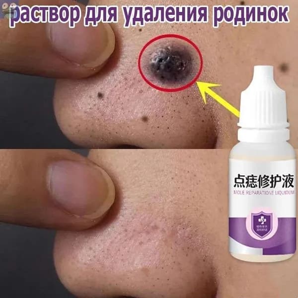 Бальзам для ухода за кожей