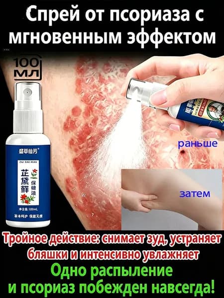 Зудайфу мазь от псориаза