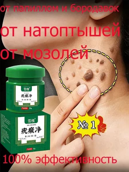 Крем для безболезненного устранения плоских и нитевидных бородавок, папиллом, остроконечных кондилом, родинок и подошвенных бородавок