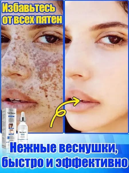 Отбеливающее и от веснушек эфирное масло, осветляет на 7 дней, аккуратно удаляет различные пигментные пятна, восстанавливает после пребывания на солнце, повышает тонус кожи, питает и увлажняет.