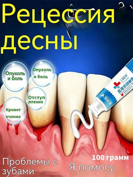 Зубная паста для дырки в зубе, глубокого кариеса и пульпита, Снимает боль, восстанавливает при поражении кариесом у взрослых, Свежее дыхание, 100 г, 1 шт.