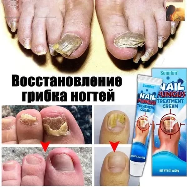 Средство для ногтей и кутикулы
