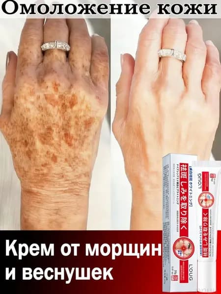Отбеливающий крем для лица, от пигментации и веснушек, для удаления мелазмы, веснушек, возрастных и других видов пятен 20 г
