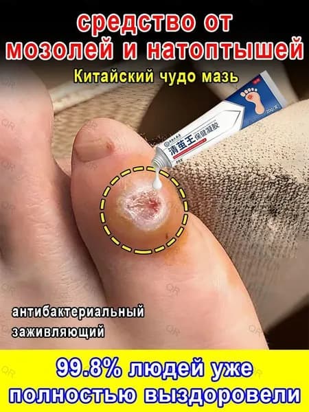 Пластырь от мозолей, стержневых натоптышей и бородавок 20 г Китайский чудо мазь