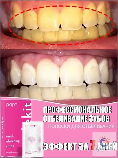 Пластыри для отбеливания зубов, подходят для удаления пятен от кофе и чая, быстро отбеливают зубы, упаковка из 14 штук, курс на 7 применений.